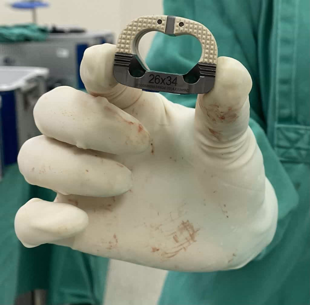 ALIF: artrodese de coluna pela barriga