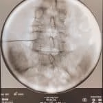 Especialista em tratamento da dor BH