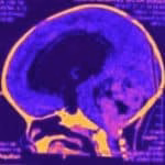 Neurocirurgião pediátrico BH