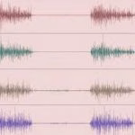 Nervo mediano