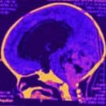 Neurocirurgia pediatrica