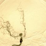 Neurocirurgia