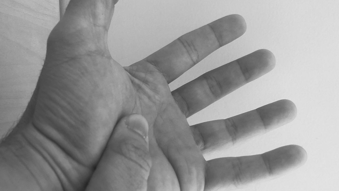 Síndrome do túnel do carpo