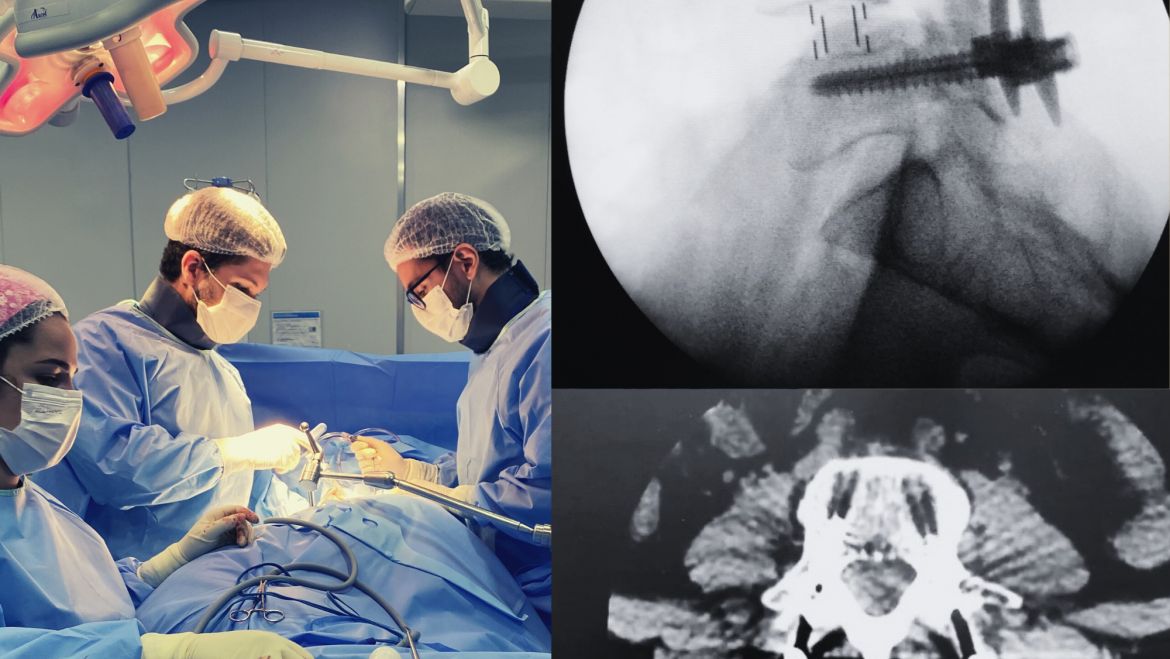 Cirurgia minimante invasiva da coluna