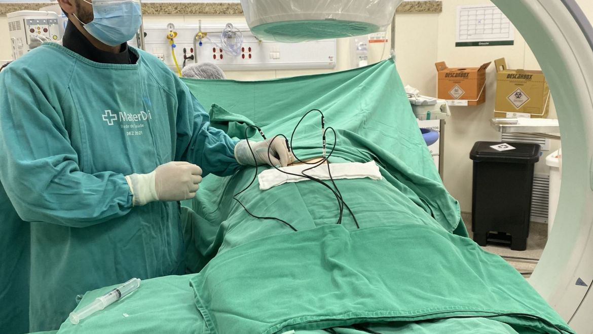 Rizotomia por radiofrequência da coluna