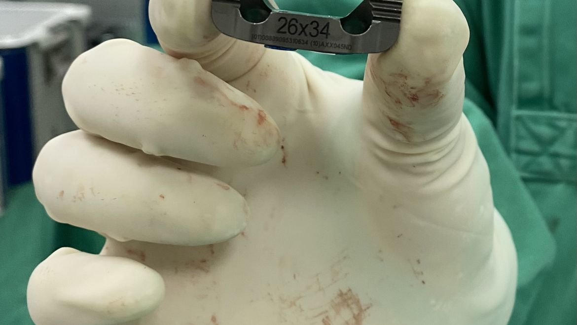 ALIF: artrodese de coluna pela barriga